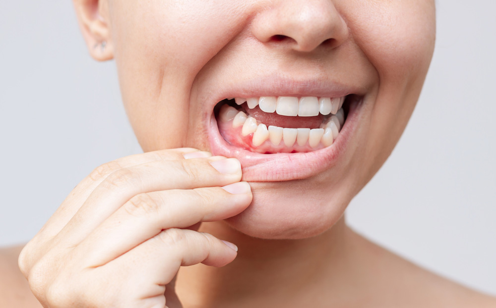 The Hidden Link Between Diabetes and Gum Disease