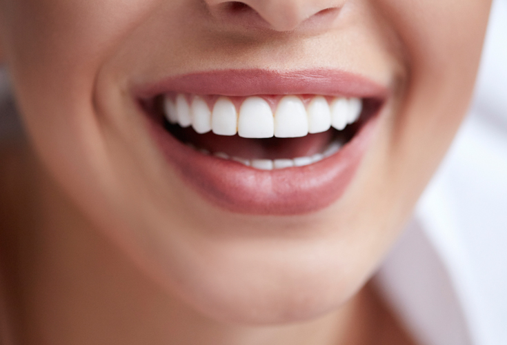 Cosmetic Dentistry