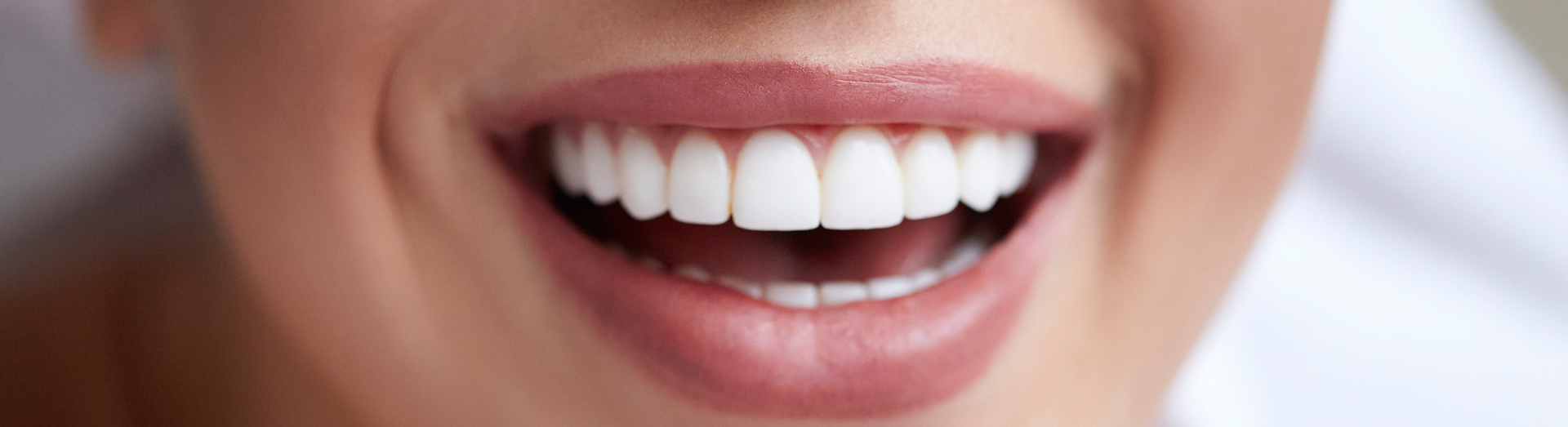 teeth whitening