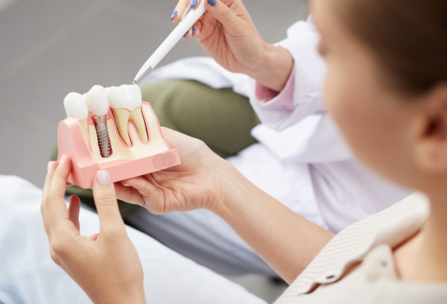 Dental Implants