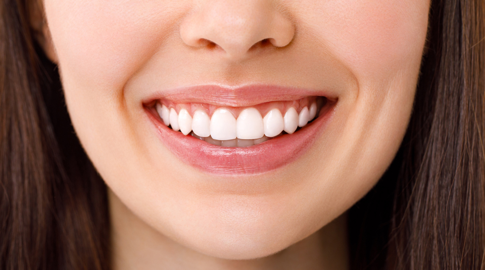 Smile Makeovers Tailored to You