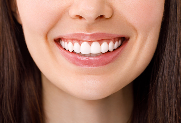 Teeth Whitening