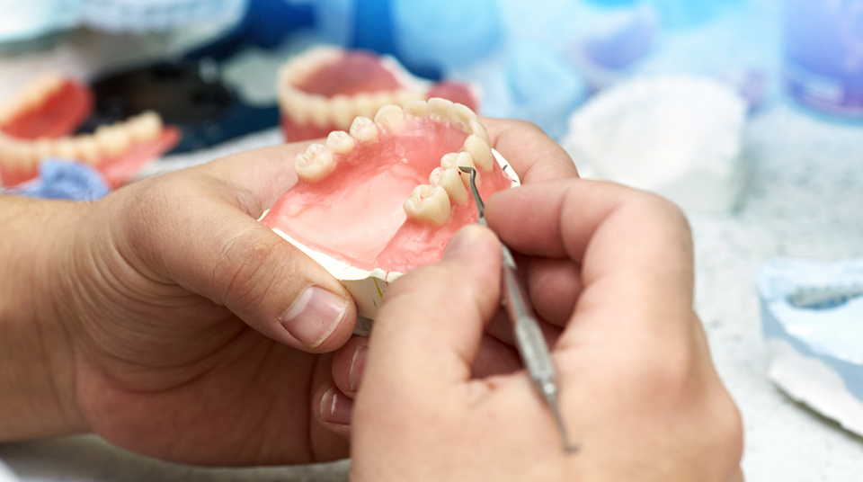 What are the different types of Dental Bridge?