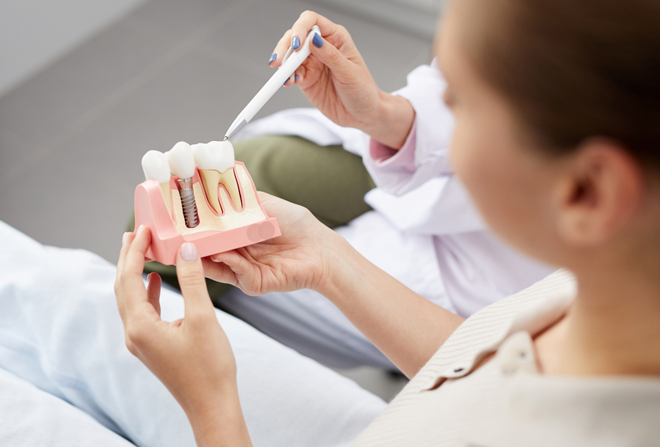 What is a Dental Implant?