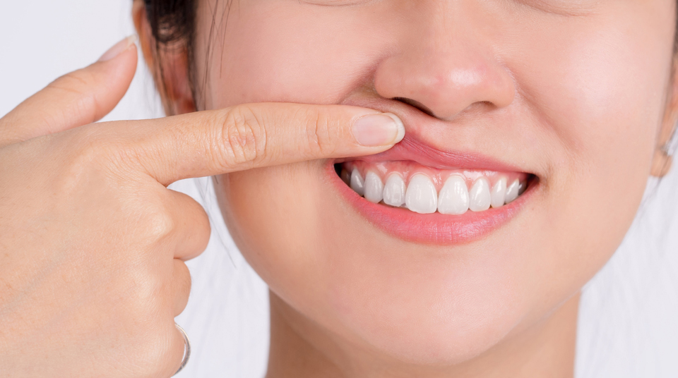 What is Periodontics?