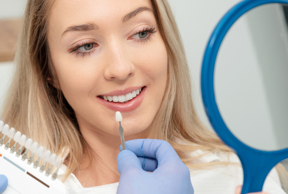 Why Choose Professional Teeth Whitening?